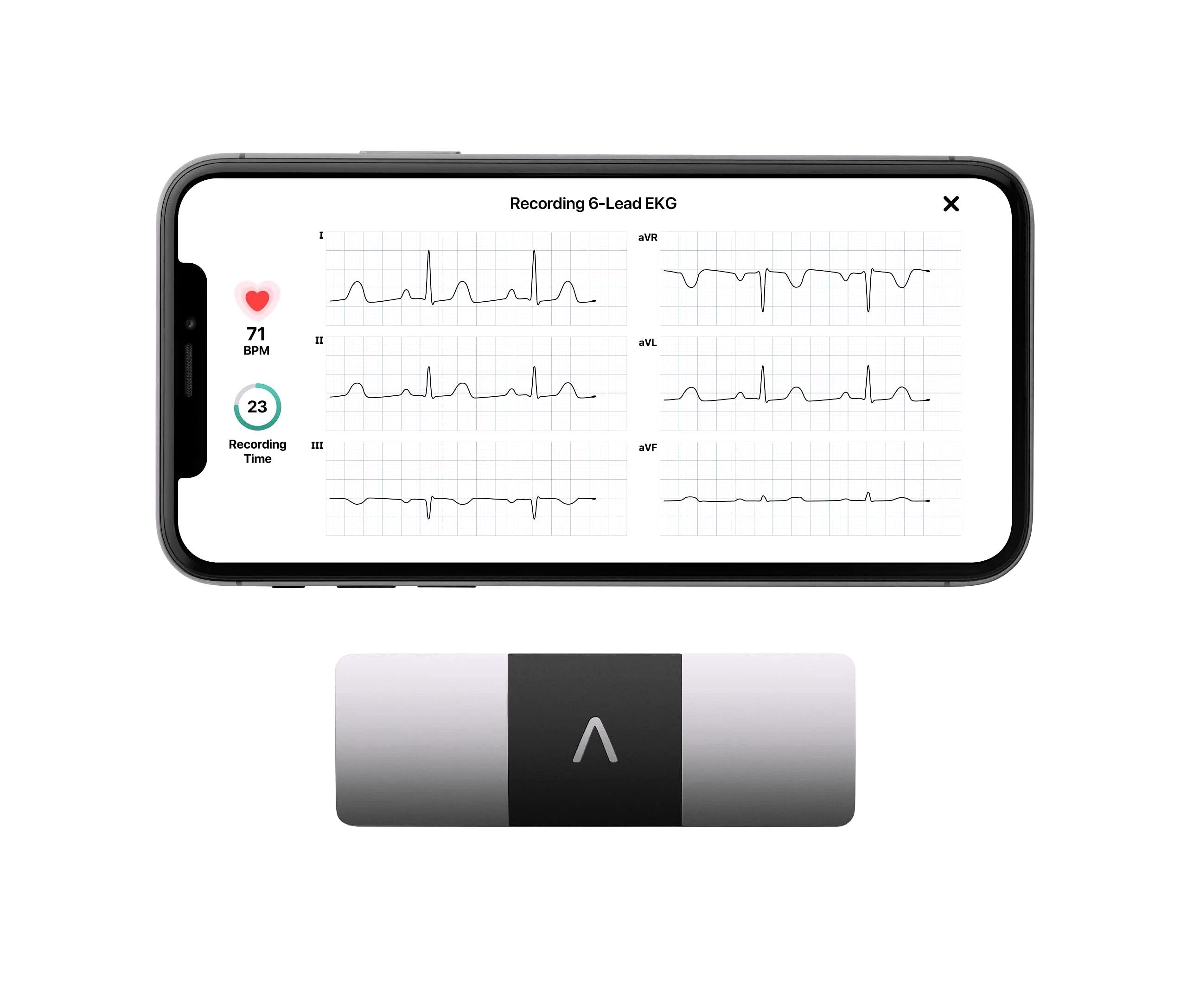 2026 KardiaMobile 6L Persönlicher EKG-Monitor für Smartphones